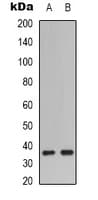 CASP9 / Caspase 9 Antibody (Internal)