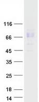 Human RYK Protein (Recombinant Myc-DDK (Flag))