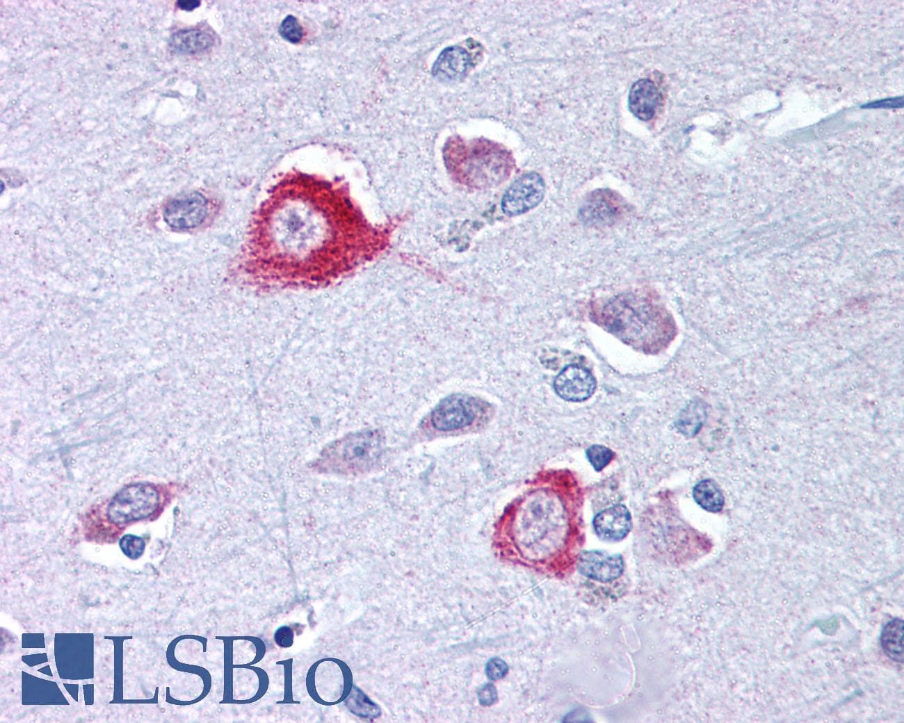 IHC-plus™ Polyclonal Rabbit anti-Mouse TNK1 Antibody (aa421-434, IHC)