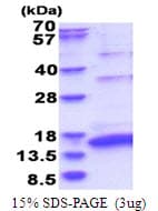 Hepatitis C Virus HCV NS5a Protein (Recombinant His)