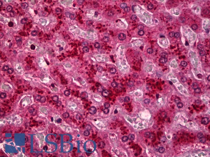 IHC-plus™ HYOU1 / ORP150 Antibody (Internal, clone EPR5890)
