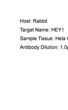 Polyclonal Rabbit anti-Human HEY1 Antibody (aa197-246, IHC, WB)