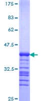 Human RELA / NFKB p65 Protein (Recombinant GST, N-terminus)