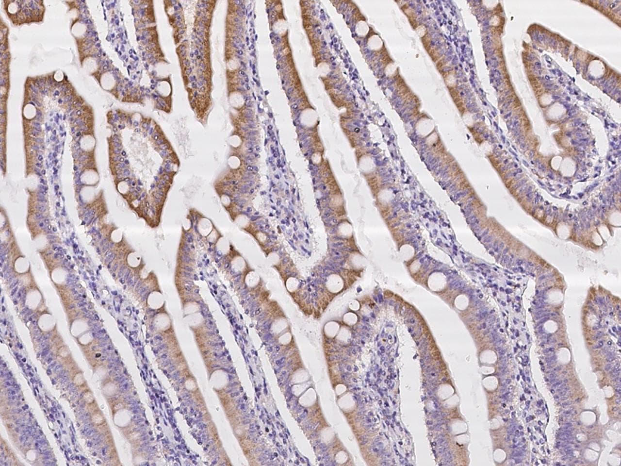 IL23 Antibody