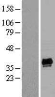 PDLIM2 / SLIM Protein (Over-Expression Lysate Myc-DDK (Flag))