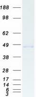 Human CTBP1 / CTBP Protein (Recombinant Myc-DDK (Flag))