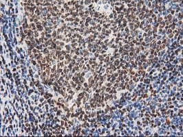 MEF2C Antibody (clone OTI4F7)