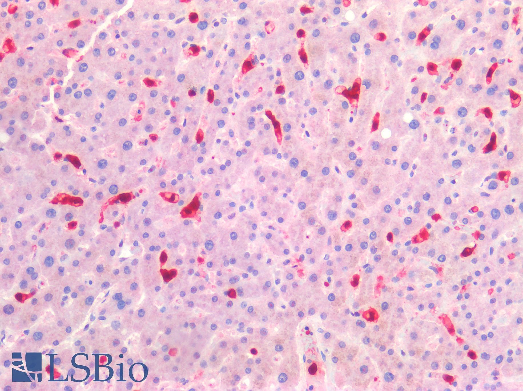 PathPlus™ Monoclonal Mouse anti-Human S100A8 / MRP8 Antibody (clone MAC 387, Azide-free, IHC)