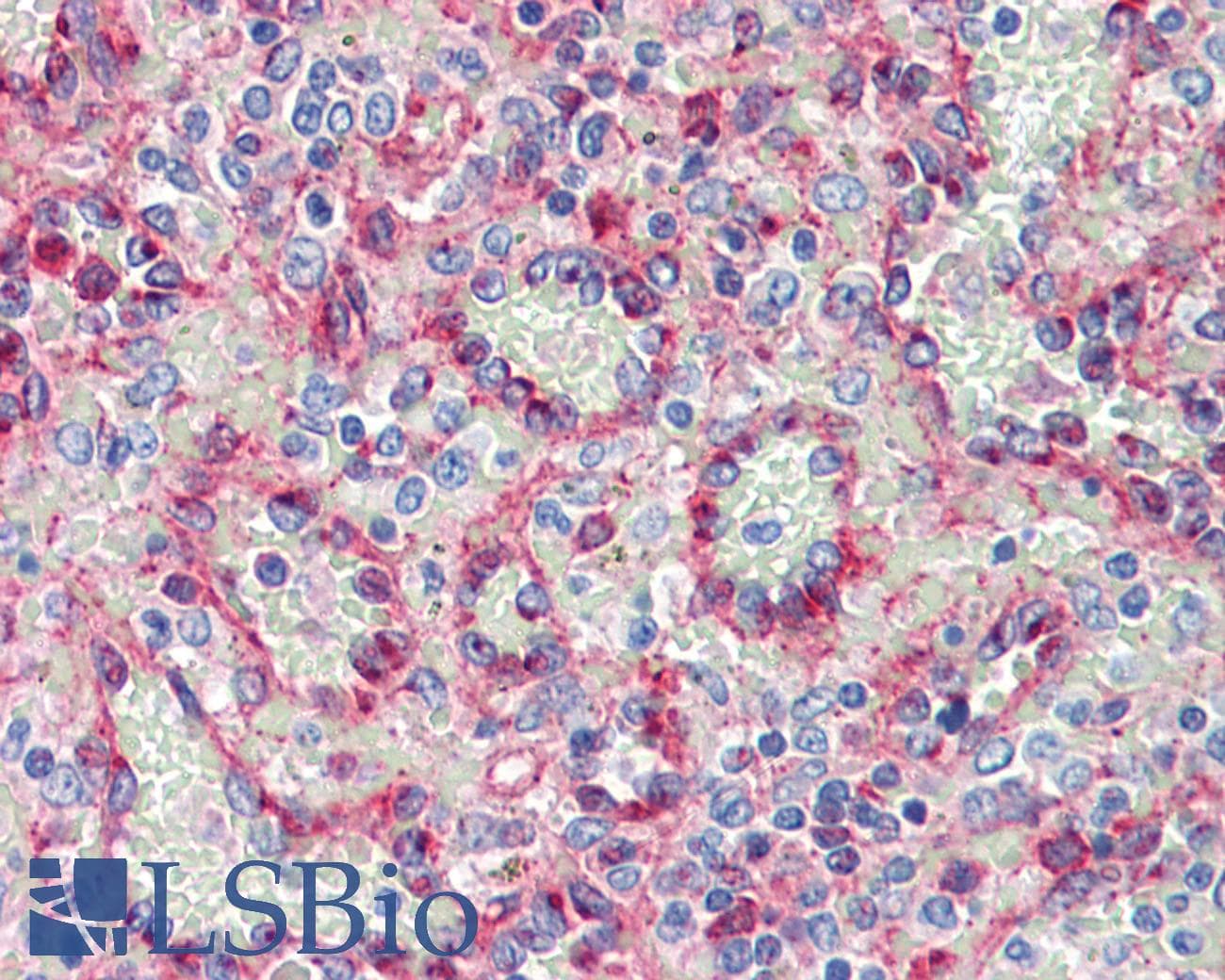 IHC-plus™ Polyclonal Rabbit anti-Human Fragilis / IFITM3 Antibody (IHC, WB)