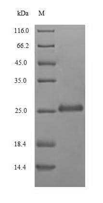 Ustilago sphaerogena RNU2 Protein (Recombinant 6His-B2M, N-terminus)