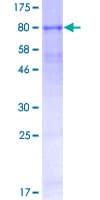 Human TMPRSS2 / Epitheliasin Protein (Recombinant GST, N-terminus)