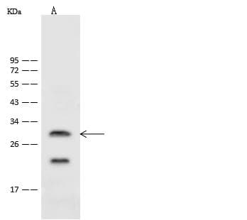 ASCL1 / MASH1 Antibody