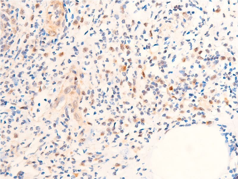 Polyclonal Rabbit anti-Human CHEK1 / CHK1 Antibody (phospho-Ser280, IHC, IF, WB)