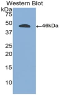 CD45 / LCA Antibody (aa193-575)