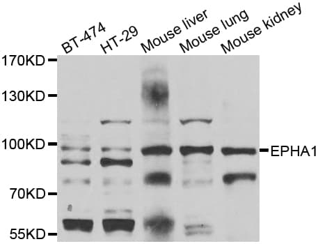 EPHA1 / EPH Receptor A1 Antibody