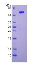 Rabbit IL6 / Interleukin 6 Protein (Recombinant His-GST, N-terminus)