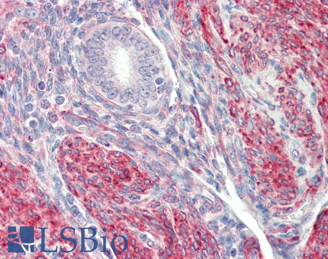 LMOD1 Antibody (N-Terminus)