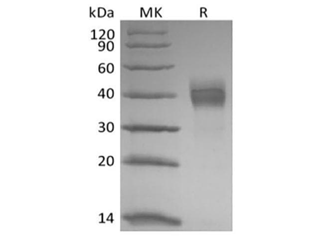 Rhesus monkey TROP2 / TACSTD2 Protein (Recombinant 6His, C-terminus)