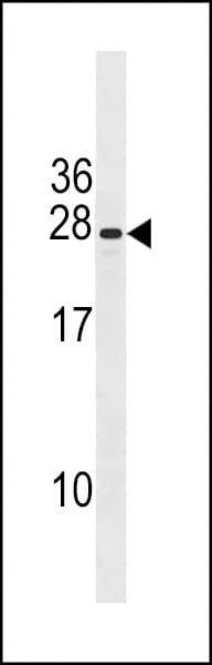 PIH1D3 Antibody (aa171-199)