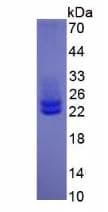 Human IL6 / Interleukin 6 Protein (Recombinant His, N-Terminal)