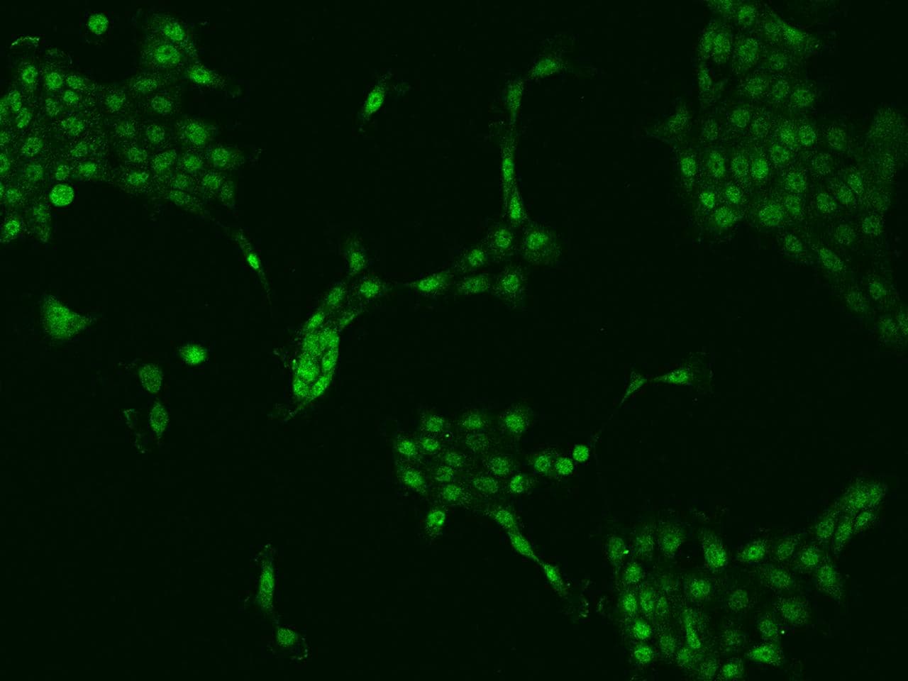 ZNF251 Antibody