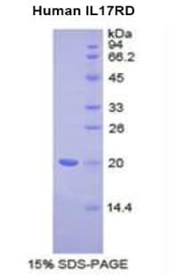 Human IL17RD Protein (Recombinant His)