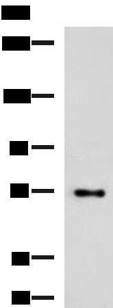 TTLL10 Antibody