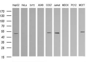 Monoclonal Mouse anti-Human TRIM38 Antibody (clone OTI16D9, IHC, WB)