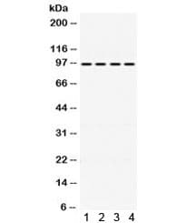 PDCD6IP / ALIX Antibody