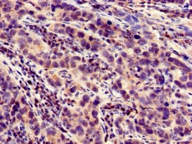 LOXHD1 Antibody