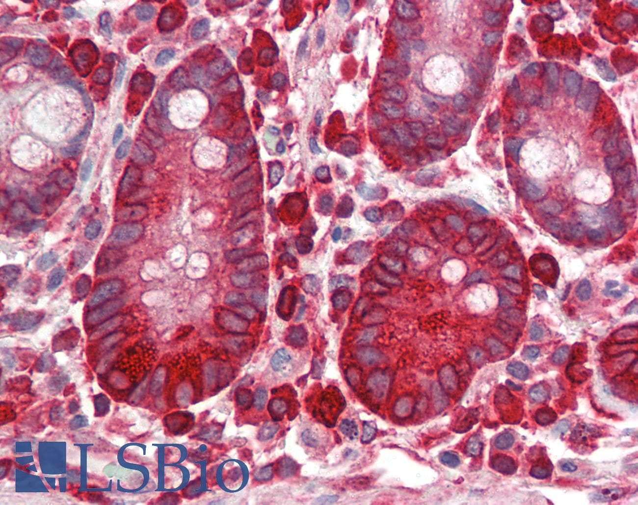 IHC-plus™ EEF2 / Elongation Factor 2 Antibody (phospho-Thr56)