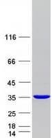 Human MEMO1 Protein (Recombinant Myc-DDK (Flag))