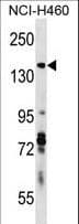 DIAPH3 / MDIA2 Antibody (aa1061-1090)
