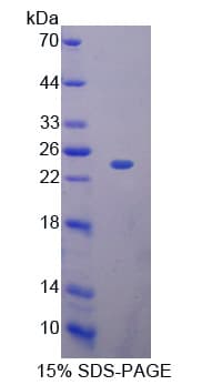 Human RNASE11 Protein (Recombinant His-T7)