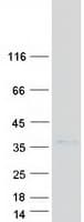Human SLIM / FHL1 Protein (Recombinant Myc-DDK (Flag))