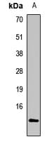Polyclonal Rabbit anti-Human MAP1LC3A / LC3A Antibody (WB)