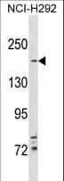 Tuberin / TSC2 Antibody (aa479-508)