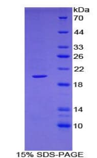Rhesus monkey TNFSF13 / APRIL Protein (Recombinant His)