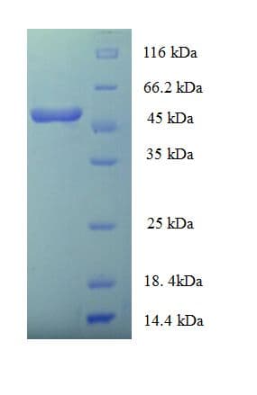 Human HLA-E Protein (Recombinant His-SUMO)