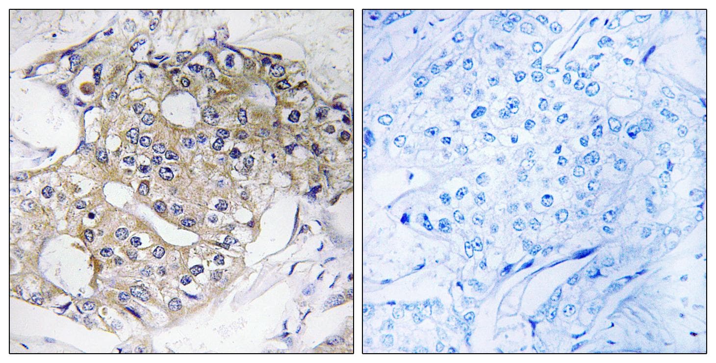 DHRS4 / PSCD Antibody