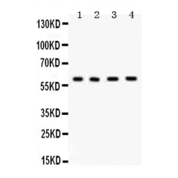ABL1 / c-ABL Antibody (aa1020-1049)