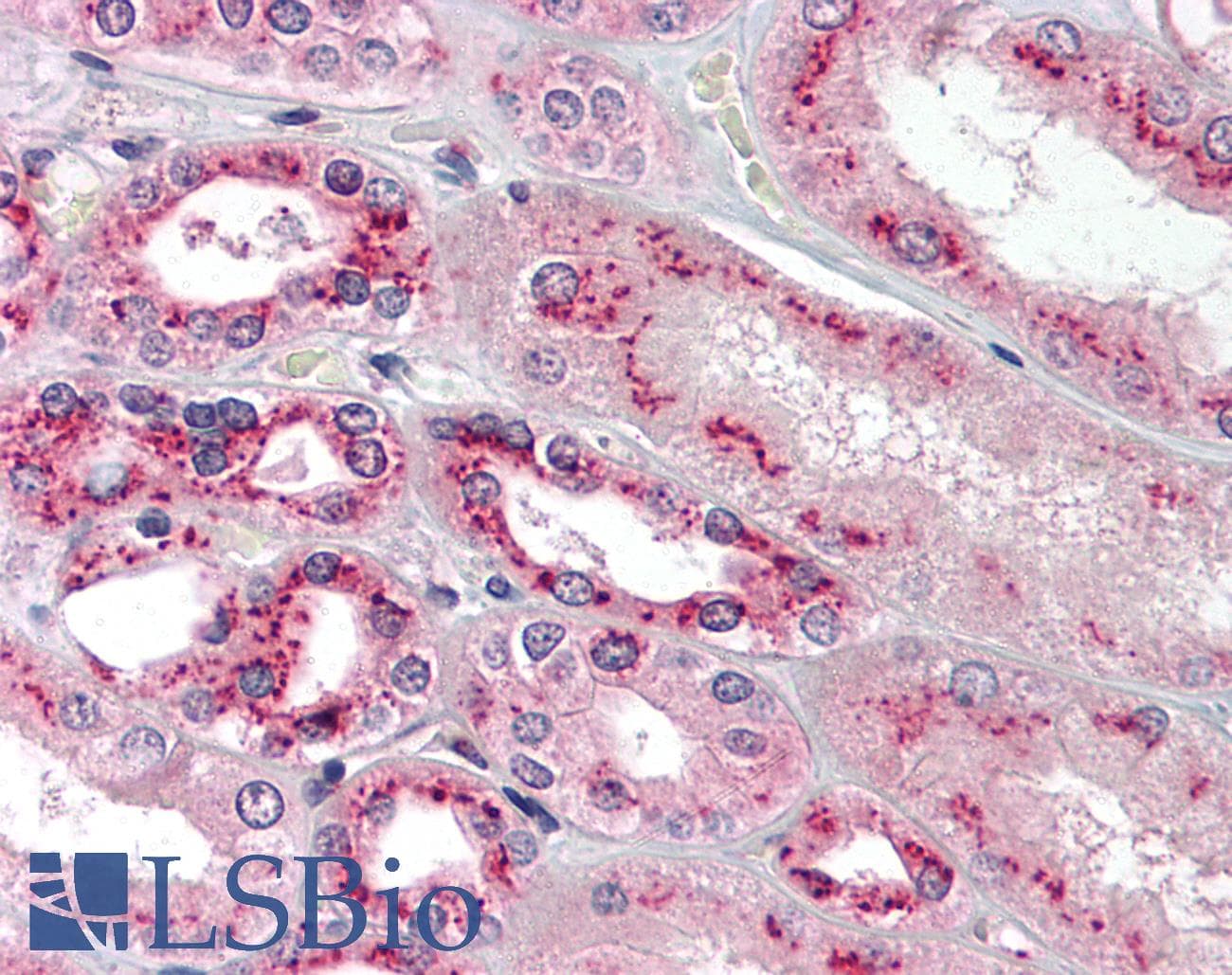 IHC-plus™ TS / Thromboxane Synthase Antibody (aa359-377)