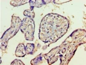 HDAC8 Antibody (aa1-377)
