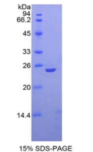 Mouse THBS1 / Thrombospondin-1 Protein (Recombinant His, N-Terminal)