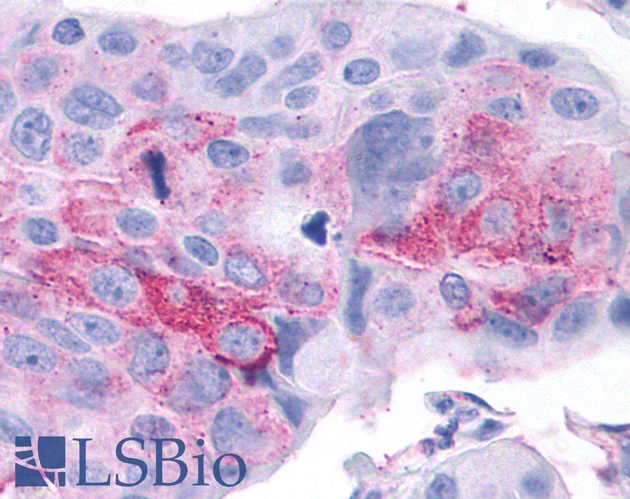 PathPlus™ Polyclonal Rabbit anti-Human RORC / ROR Gamma Antibody (Ligand-binding Domain, IHC)