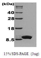 Human IL8 / Interleukin 8 Protein (Recombinant)