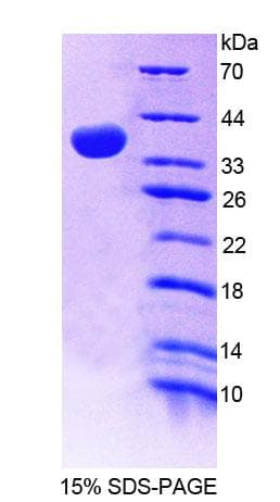 Mouse GBP4 / Mpa2 Protein (Recombinant His-T7)