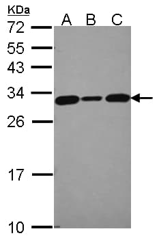 Polyclonal Rabbit anti-Human CACYBP Antibody (aa1-228, WB)