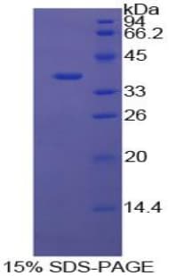 Bovine ANXA5 / Annexin V Protein (Recombinant His)