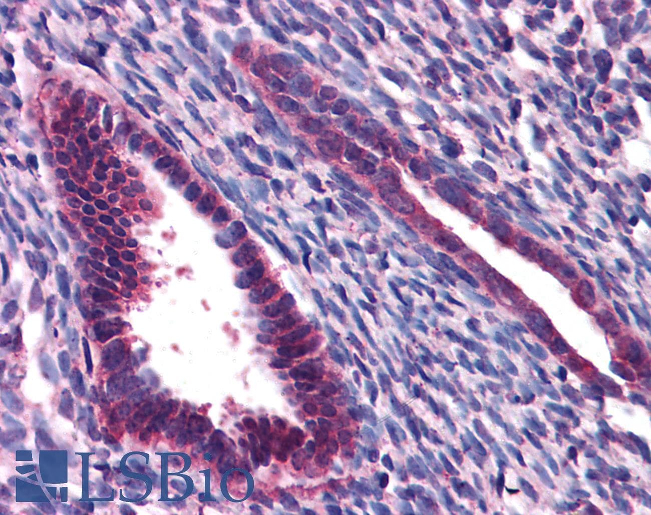 IHC-plus™ Polyclonal Rabbit anti-Human JMJD1C Antibody (IHC, IF, WB)